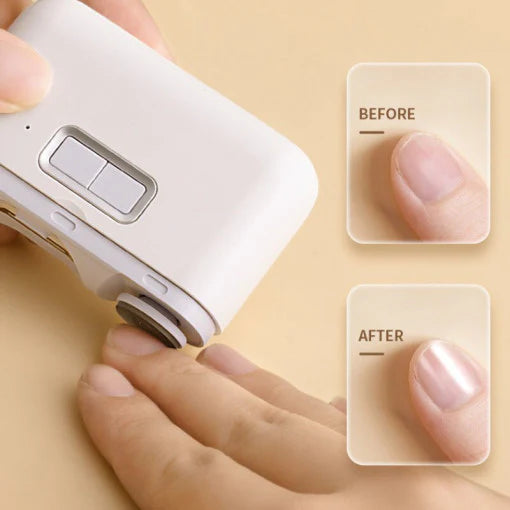 Mini smart nail clipper - Prozone