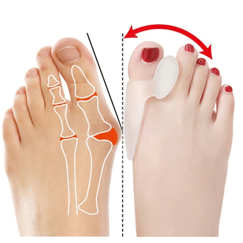 1 pair silicone gel foot fingers toe separator thumb valgus protector