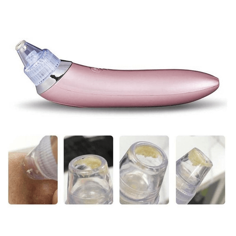 Blackhead remover- pore facial cleanser beauty machine