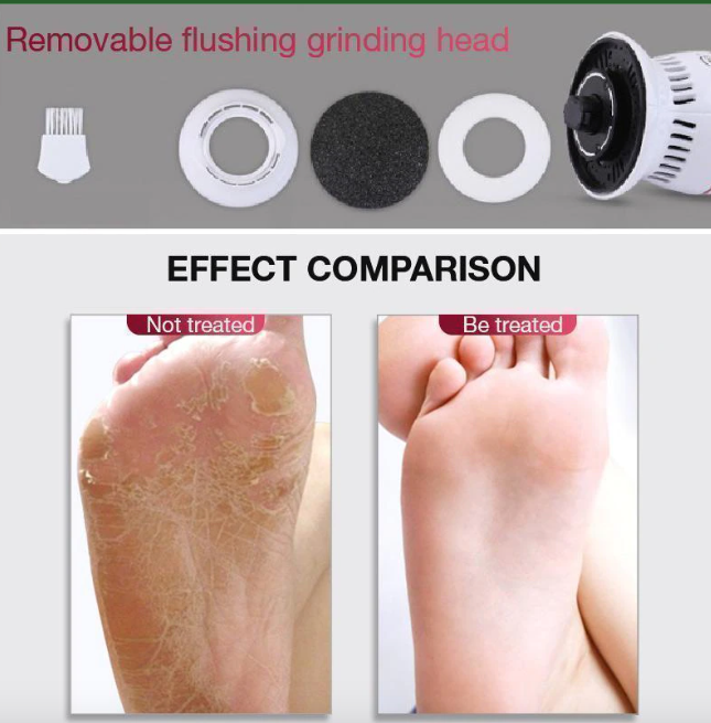 Callus remover with built-in vacuum electric foot grinder - Prozone