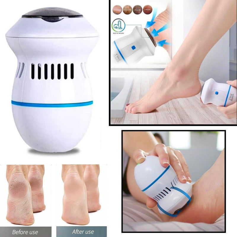Callus remover with built-in vacuum electric foot grinder - Prozone
