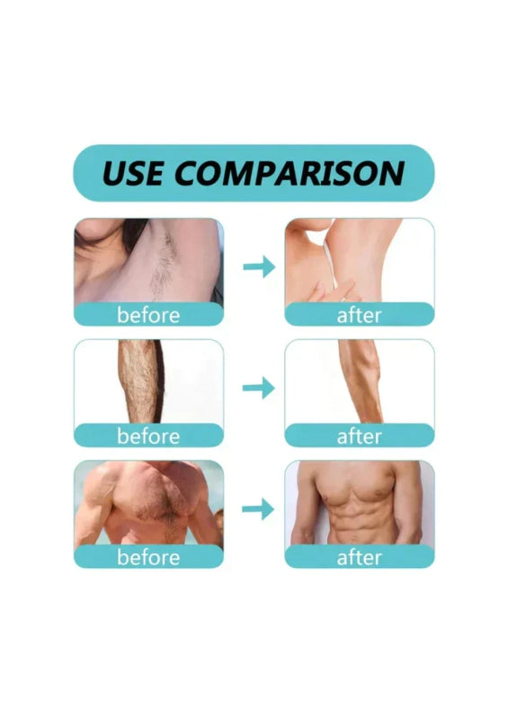 Ecrin hair removal spray - Prozone